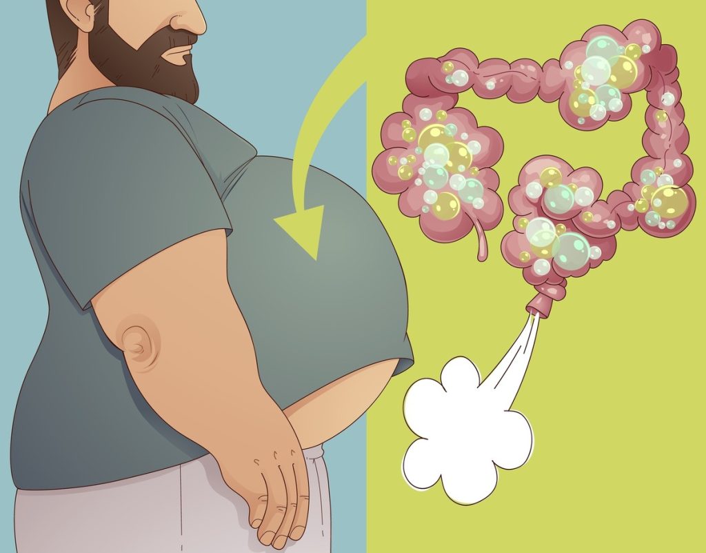 How to Stop Bloating Permanently: